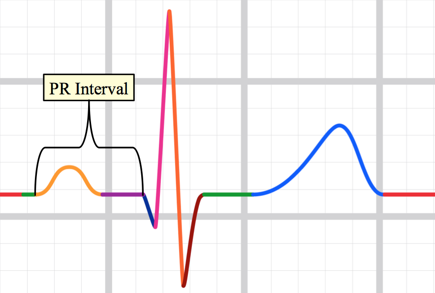 Teaching Medicine - Tutorial: Analyze the Waveforms